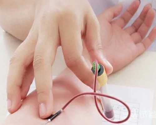 国内供卵代孕包生男孩,办理失独家庭手续流程（失独家庭手续怎么办理）