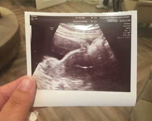 中国试管用供卵需要多少费用,做试管婴儿需要吗？如何挑选泰国试管服务机构