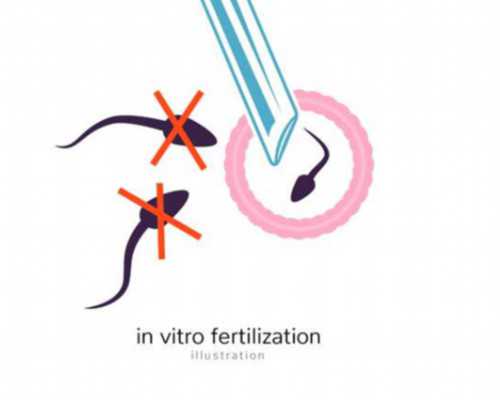 国内试管供卵包男孩多少钱,卵泡发育不良怎么办(什么是卵泡发育不良)