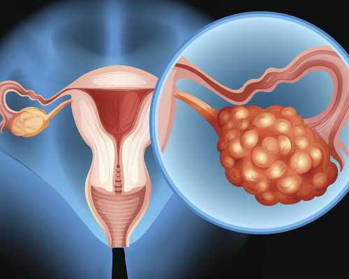 泰国全球的试管婴儿医院,高龄试管代怀