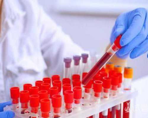 国内正规供卵试管,婴儿眼屎多且黄还粘稠，新*儿眼屎多是因为上火吗